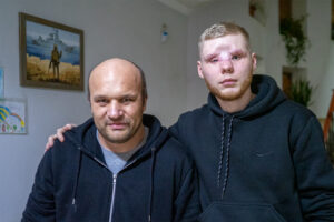 Ruský plynový útok: v bunkri sa zadusíš, vonku ťa dostane granát